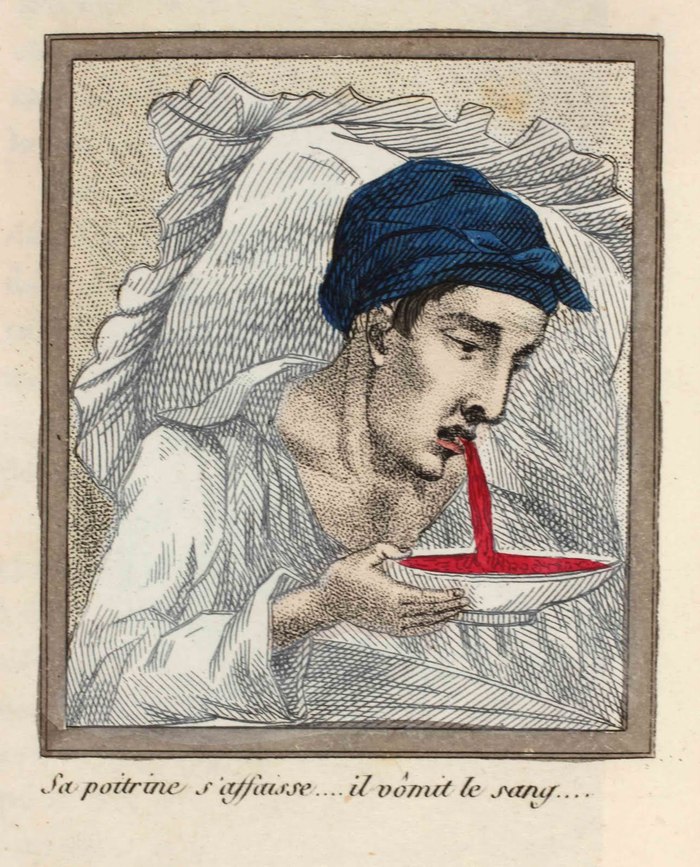 A Lost Battle - Series About History and Art in an Adult Way 18, 18+, My, History (science), The medicine, 18th-19th century, Health, Longpost, NSFW