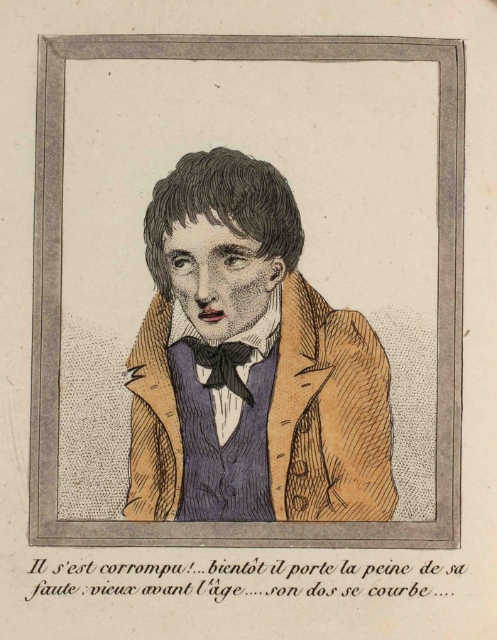 A Lost Battle - Series About History and Art in an Adult Way 18, 18+, My, History (science), The medicine, 18th-19th century, Health, Longpost, NSFW