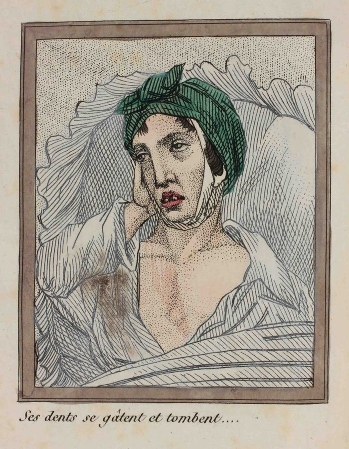 A Lost Battle - Series About History and Art in an Adult Way 18, 18+, My, History (science), The medicine, 18th-19th century, Health, Longpost, NSFW