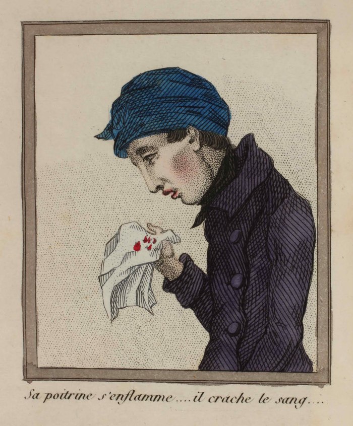 A Lost Battle - Series About History and Art in an Adult Way 18, 18+, My, History (science), The medicine, 18th-19th century, Health, Longpost, NSFW