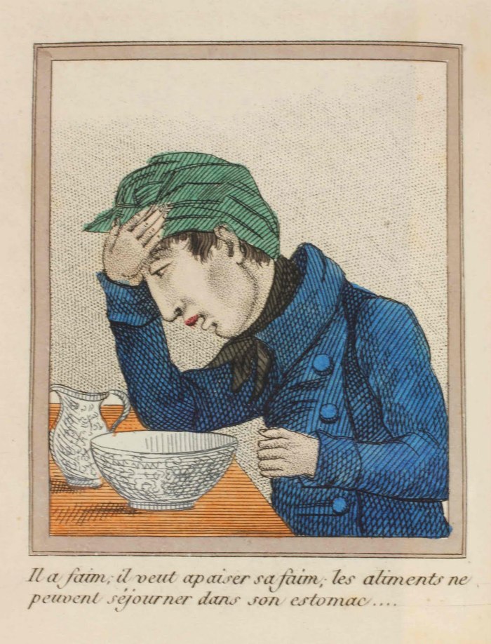 A Lost Battle - Series About History and Art in an Adult Way 18, 18+, My, History (science), The medicine, 18th-19th century, Health, Longpost, NSFW