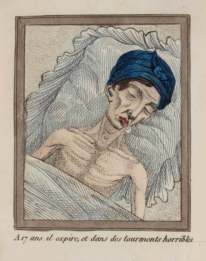 A Lost Battle - Series About History and Art in an Adult Way 18, 18+, My, History (science), The medicine, 18th-19th century, Health, Longpost, NSFW