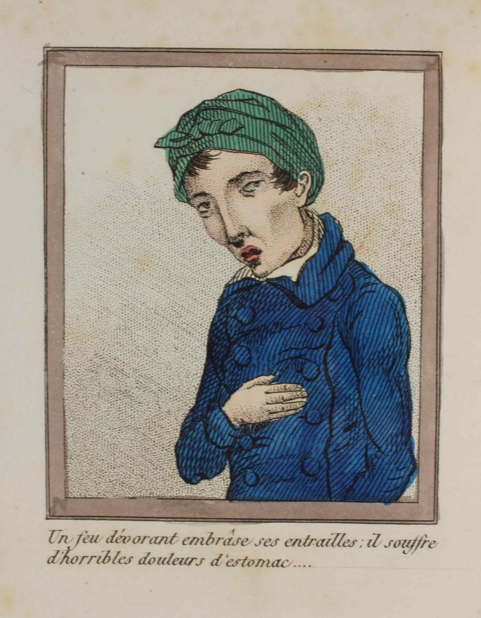 A Lost Battle - Series About History and Art in an Adult Way 18, 18+, My, History (science), The medicine, 18th-19th century, Health, Longpost, NSFW
