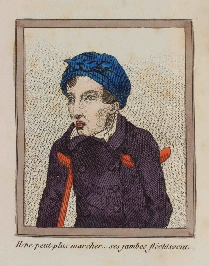 A Lost Battle - Series About History and Art in an Adult Way 18, 18+, My, History (science), The medicine, 18th-19th century, Health, Longpost, NSFW