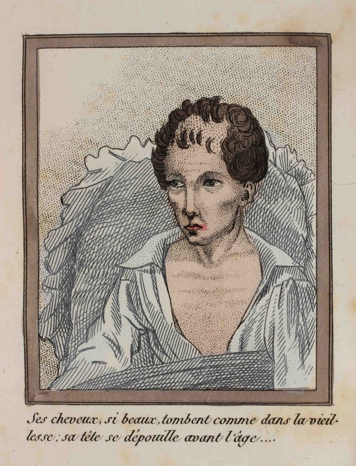 A Lost Battle - Series About History and Art in an Adult Way 18, 18+, My, History (science), The medicine, 18th-19th century, Health, Longpost, NSFW